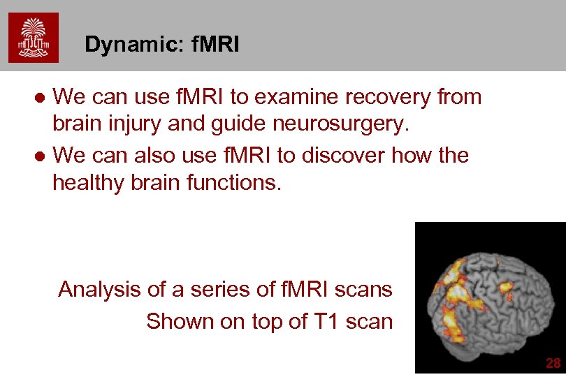 Dynamic: f. MRI We can use f. MRI to examine recovery from brain injury