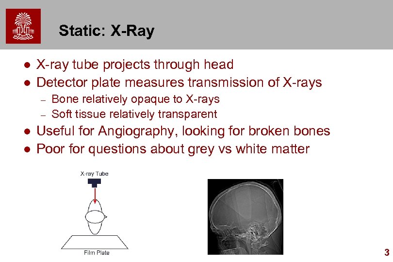 Static: X-Ray l l X-ray tube projects through head Detector plate measures transmission of