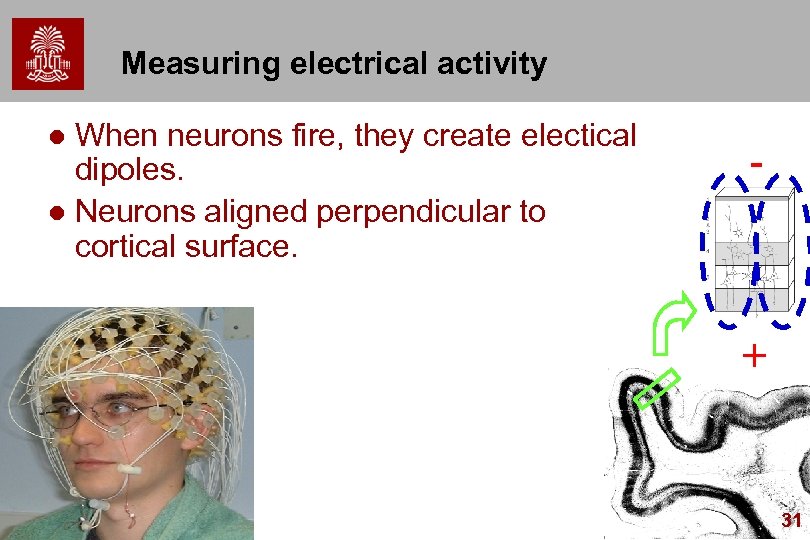 Measuring electrical activity When neurons fire, they create electical dipoles. l Neurons aligned perpendicular