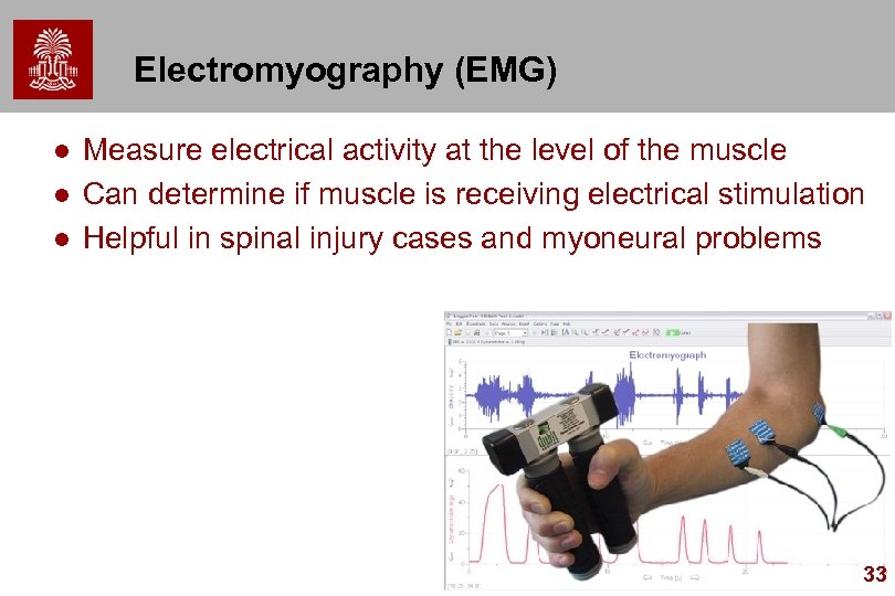 Electromyography (EMG) l l l Measure electrical activity at the level of the muscle