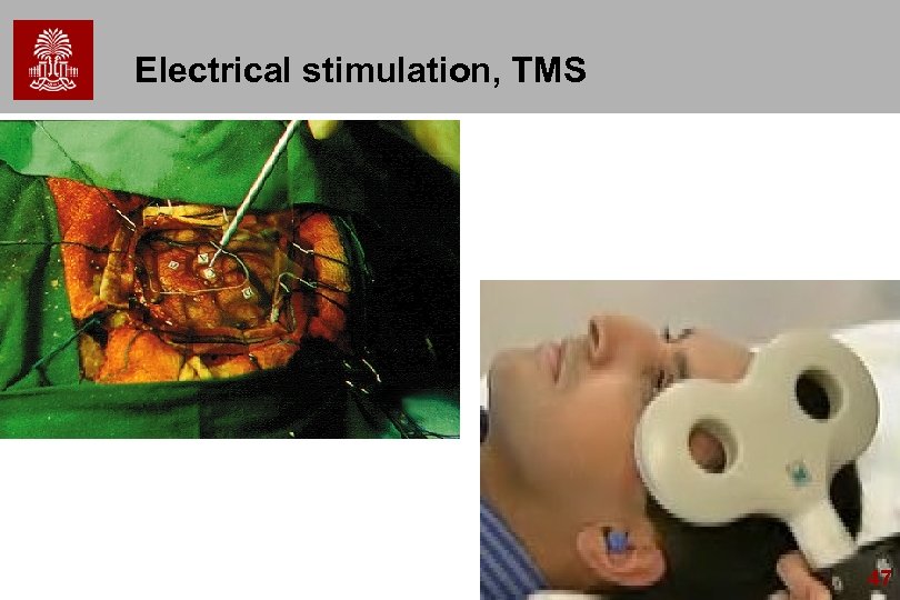 Electrical stimulation, TMS 47 