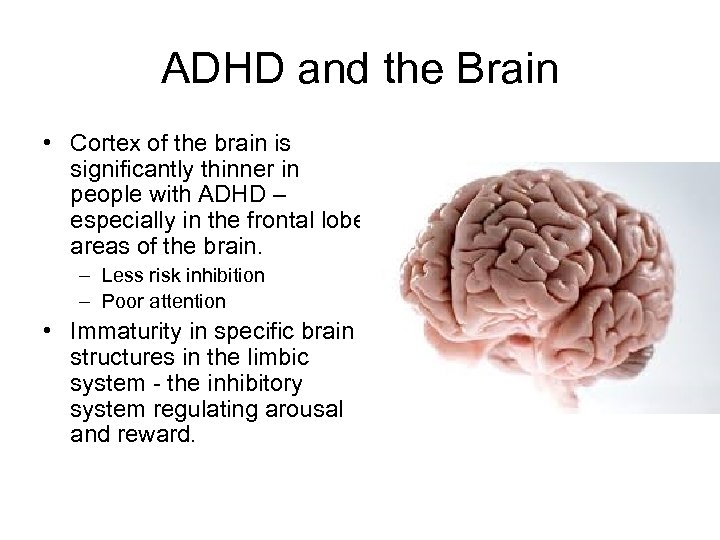 ADHD and the Brain • Cortex of the brain is significantly thinner in people