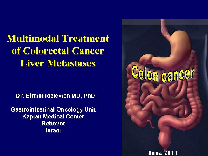 Multimodal Treatment Of Colorectal Cancer Liver Metastases Dr