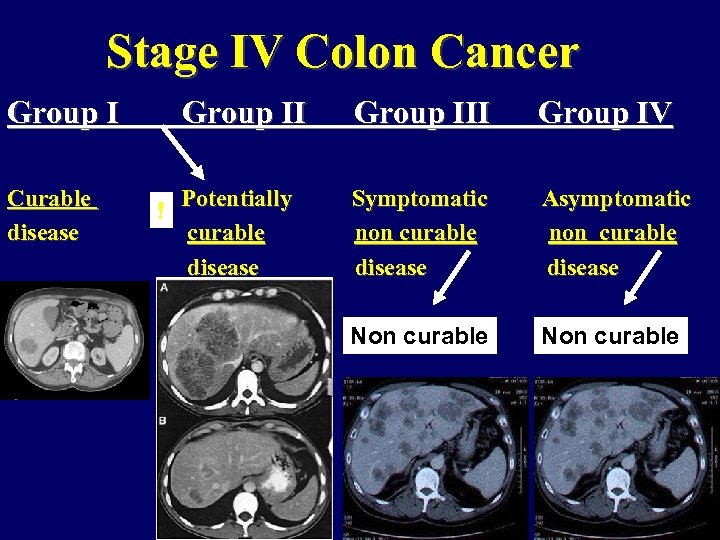 Stage IV Colon Cancer Group I Curable disease Group II ! Group III Group