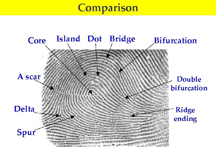 Comparison Core A scar Delta Spur Island Dot Bridge Bifurcation Double bifurcation Ridge ending