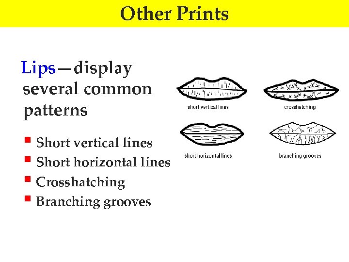 Other Prints Lips—display several common patterns § Short vertical lines § Short horizontal lines