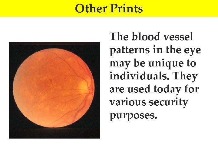 Other Prints The blood vessel patterns in the eye may be unique to individuals.