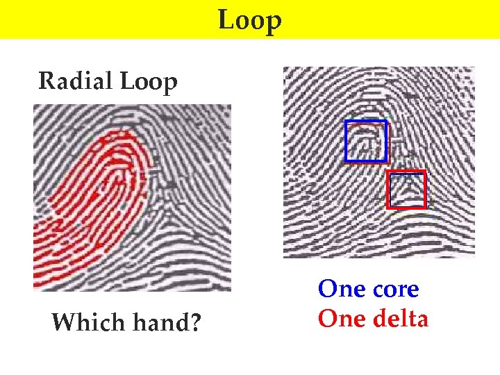 Loop Radial Loop Which hand? One core One delta 