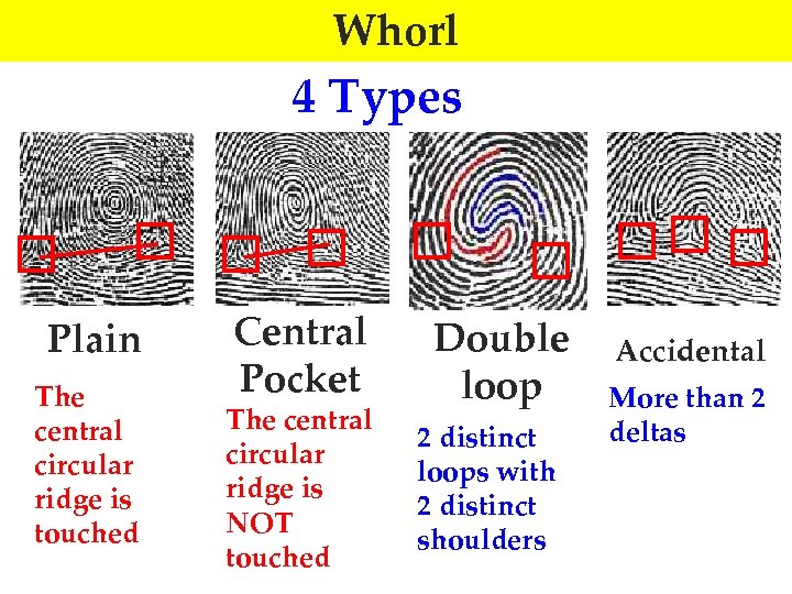 Whorl 4 Types Plain The central circular ridge is touched Central Pocket The central