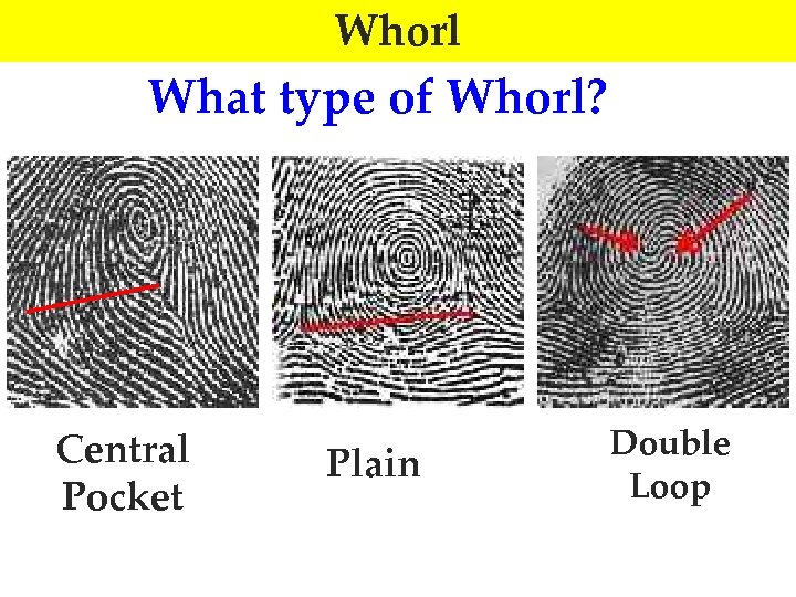 Whorl What type of Whorl? Central Pocket Plain Double Loop 