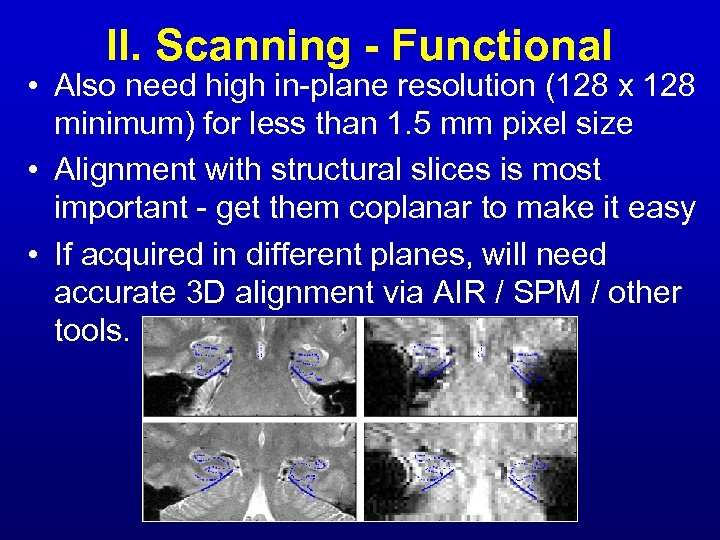 II. Scanning - Functional • Also need high in-plane resolution (128 x 128 minimum)