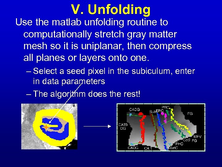 V. Unfolding Use the matlab unfolding routine to computationally stretch gray matter mesh so