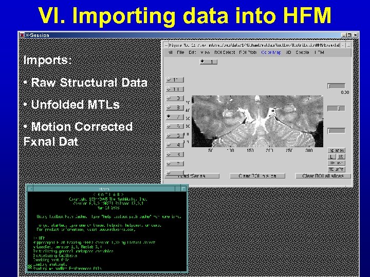VI. Importing data into HFM Imports: • Raw Structural Data • Unfolded MTLs •
