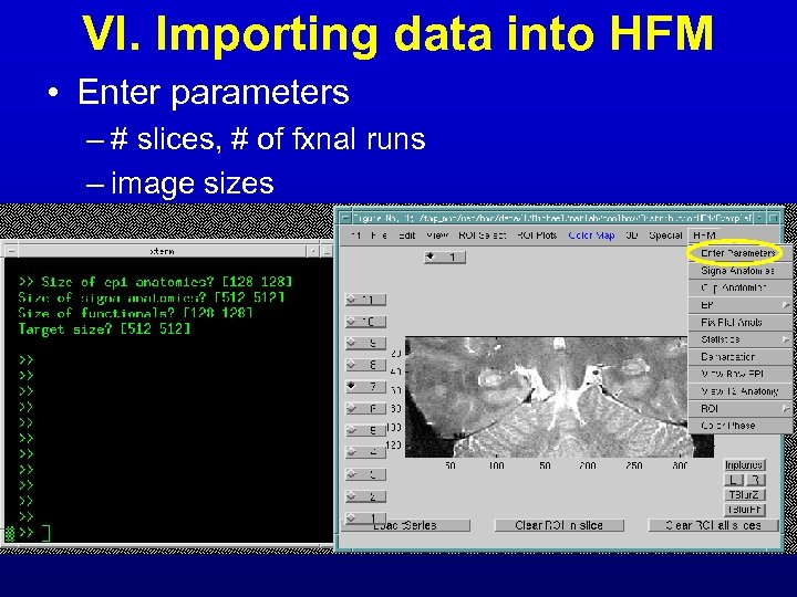 VI. Importing data into HFM • Enter parameters – # slices, # of fxnal