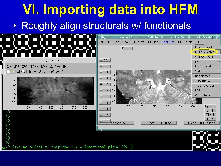 VI. Importing data into HFM • Roughly align structurals w/ functionals 