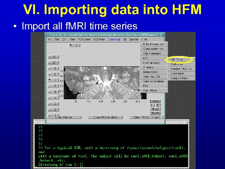 VI. Importing data into HFM • Import all f. MRI time series 
