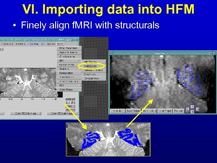 VI. Importing data into HFM • Finely align f. MRI with structurals 