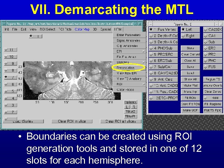 VII. Demarcating the MTL • Boundaries can be created using ROI generation tools and