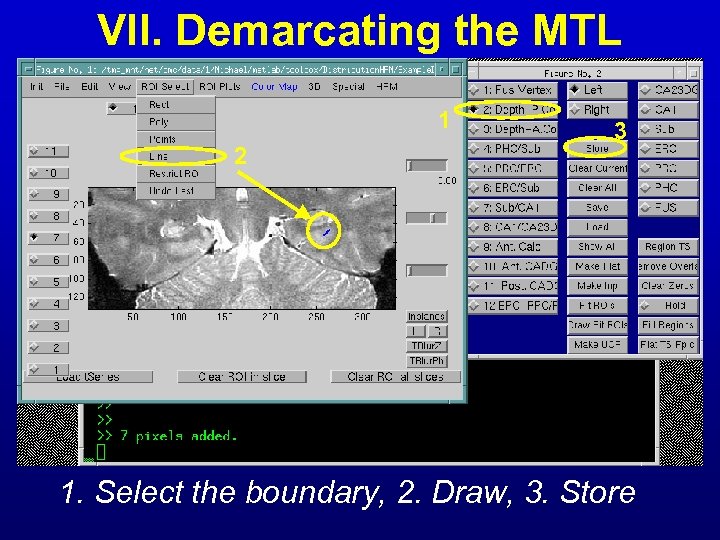 VII. Demarcating the MTL 1 2 3 1. Select the boundary, 2. Draw, 3.