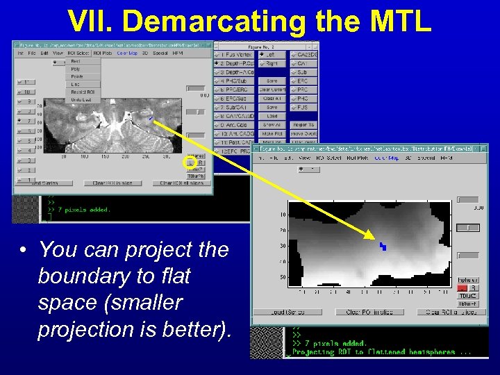 VII. Demarcating the MTL • You can project the boundary to flat space (smaller