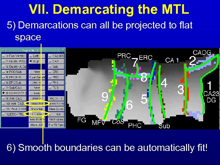 VII. Demarcating the MTL 5) Demarcations can all be projected to flat space 6)
