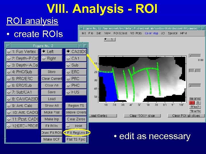 VIII. Analysis - ROI analysis • create ROIs • edit as necessary 