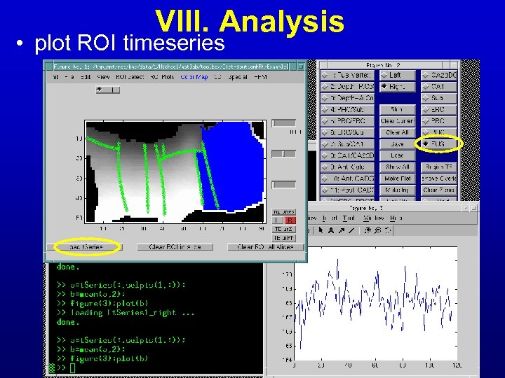 VIII. Analysis • plot ROI timeseries 