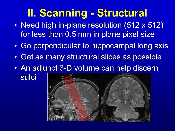 II. Scanning - Structural • Need high in-plane resolution (512 x 512) for less
