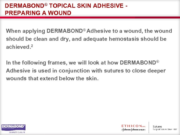 DERMABOND® TOPICAL SKIN ADHESIVE PREPARING A WOUND When applying DERMABOND® Adhesive to a wound,