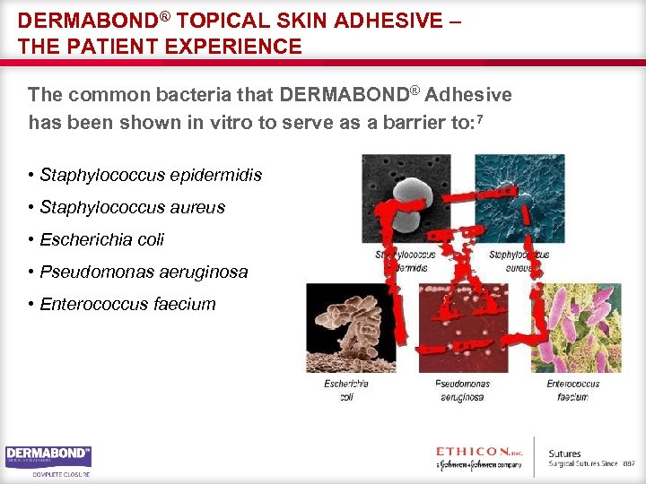 DERMABOND® TOPICAL SKIN ADHESIVE – THE PATIENT EXPERIENCE The common bacteria that DERMABOND® Adhesive