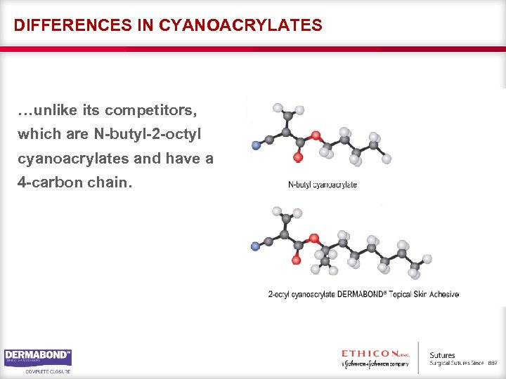 DIFFERENCES IN CYANOACRYLATES …unlike its competitors, which are N-butyl-2 -octyl cyanoacrylates and have a