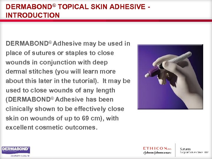 DERMABOND® TOPICAL SKIN ADHESIVE INTRODUCTION DERMABOND® Adhesive may be used in place of sutures