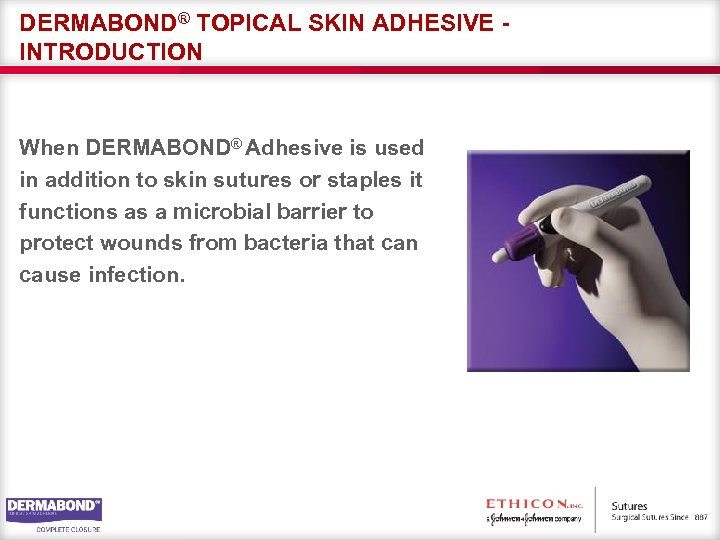 DERMABOND® TOPICAL SKIN ADHESIVE INTRODUCTION When DERMABOND® Adhesive is used in addition to skin