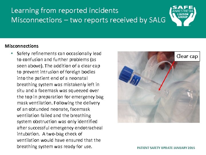 Learning from reported incidents Misconnections – two reports received by SALG Misconnections • Safety