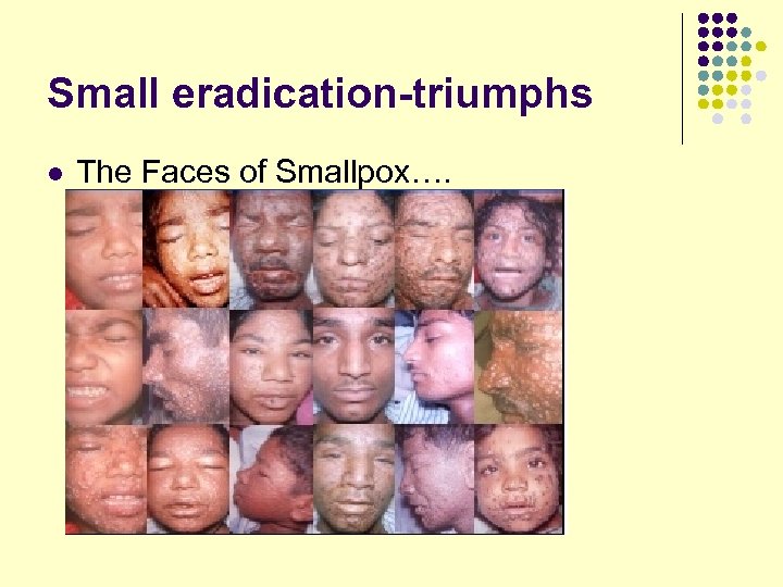 Small eradication-triumphs l The Faces of Smallpox…. 