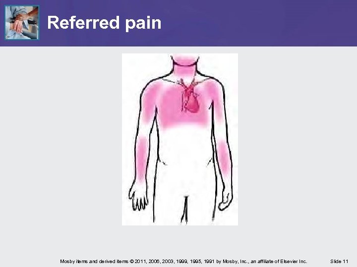 Referred pain Mosby items and derived items © 2011, 2006, 2003, 1999, 1995, 1991