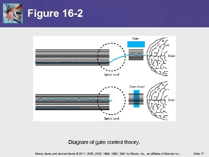 Figure 16 -2 Diagram of gate control theory. Mosby items and derived items ©