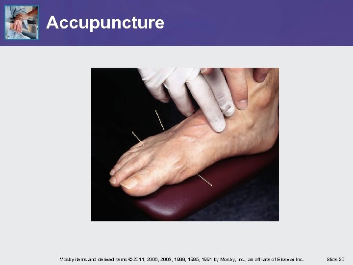 Accupuncture Mosby items and derived items © 2011, 2006, 2003, 1999, 1995, 1991 by