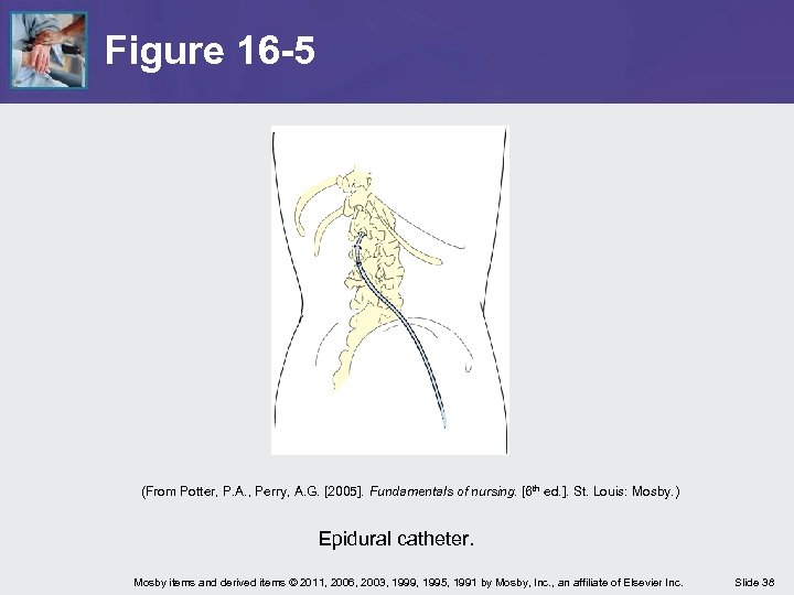 Figure 16 -5 (From Potter, P. A. , Perry, A. G. [2005]. Fundamentals of