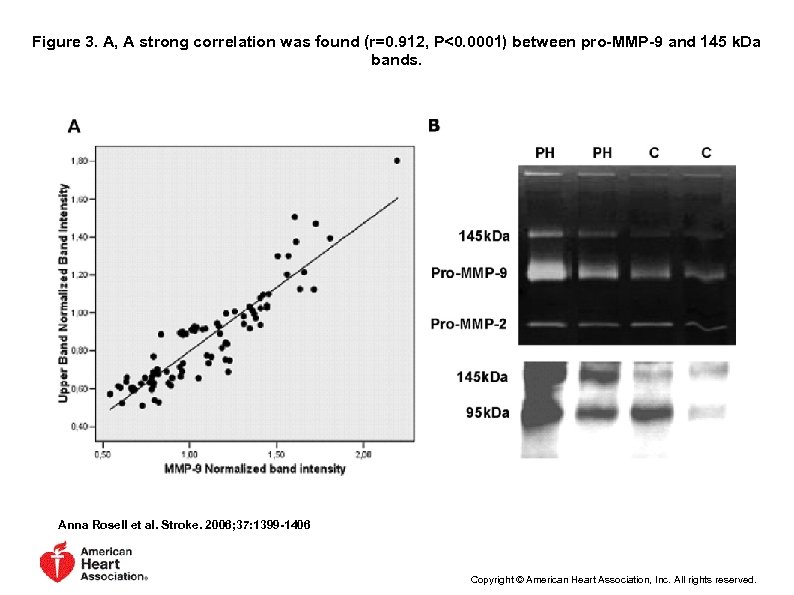 Figure 3. A, A strong correlation was found (r=0. 912, P<0. 0001) between pro-MMP-9