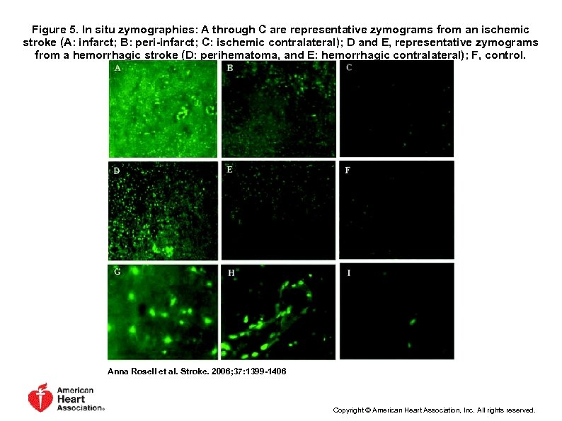 Figure 5. In situ zymographies: A through C are representative zymograms from an ischemic
