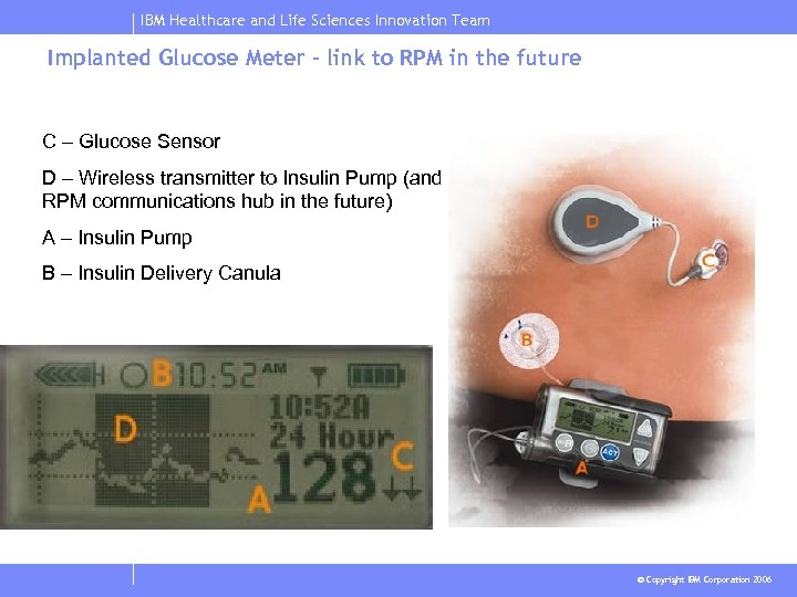 IBM Healthcare and Life Sciences Innovation Team Implanted Glucose Meter – link to RPM