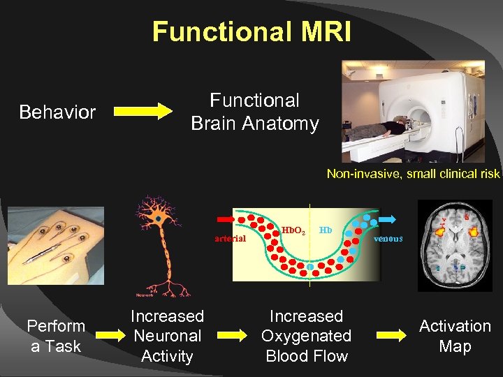 Functional MRI Behavior Functional Brain Anatomy Non-invasive, small clinical risk arterial Perform a Task