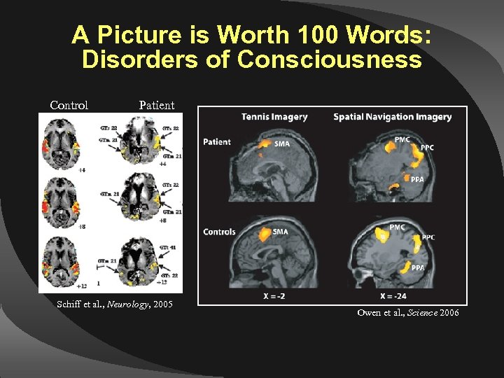 A Picture is Worth 100 Words: Disorders of Consciousness Control Patient Schiff et al.