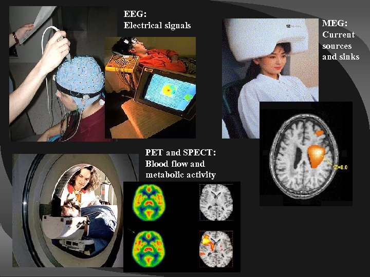 EEG: Electrical signals PET and SPECT: Blood flow and metabolic activity MEG: Current sources