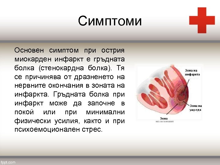 Симптоми Основен симптом при острия миокарден инфаркт е гръдната болка (стенокардна болка). Тя се