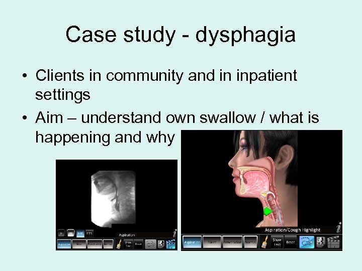 Case study - dysphagia • Clients in community and in inpatient settings • Aim