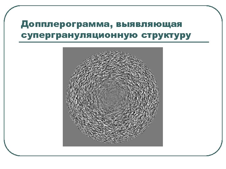 Допплерограмма, выявляющая супергрануляционную структуру 