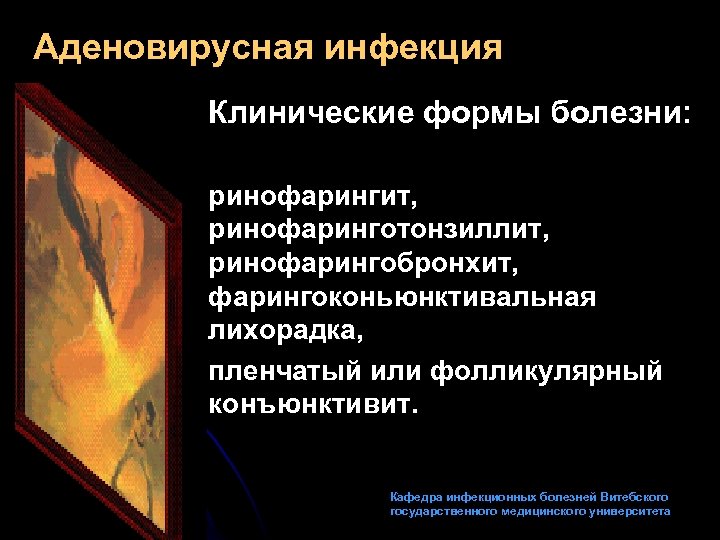 Аденовирусная инфекция Клинические формы болезни: ринофарингит, ринофаринготонзиллит, ринофарингобронхит, фарингоконьюнктивальная лихорадка, пленчатый или фолликулярный конъюнктивит.