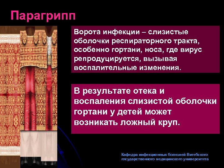 Парагрипп Ворота инфекции – слизистые оболочки респираторного тракта, особенно гортани, носа, где вирус репродуцируется,